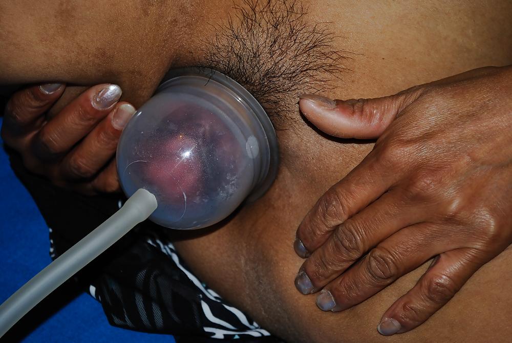 25P Thai pump Fotze dick