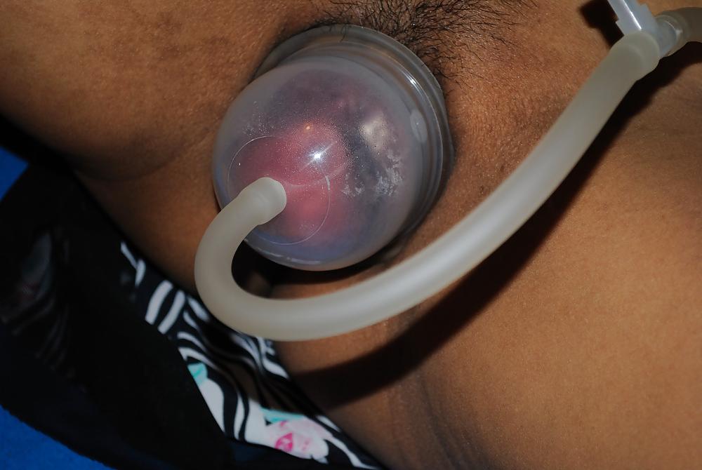 25P Thai pump Fotze dick