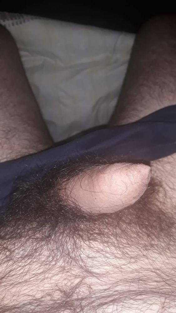 17P Moja guza 2