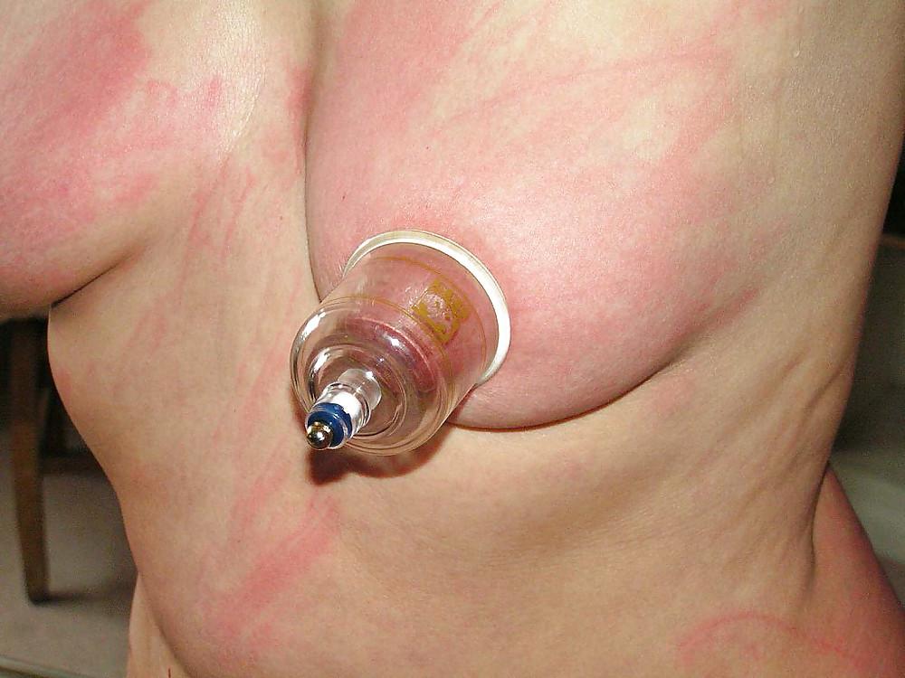 13P Pain nippels mature
