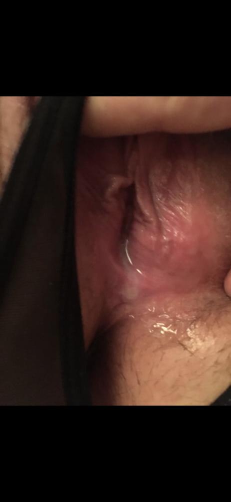 9P BBW4