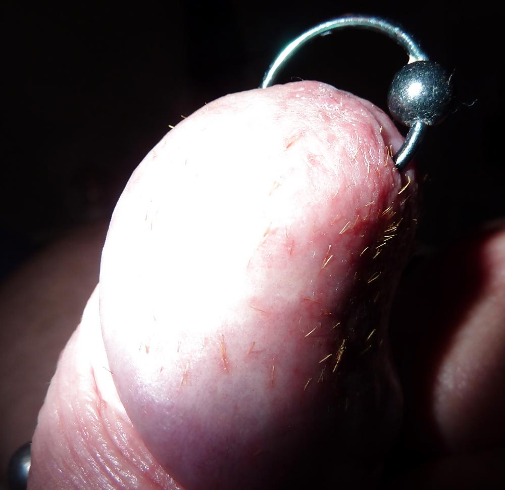 6P 24 hours on and the pain continues