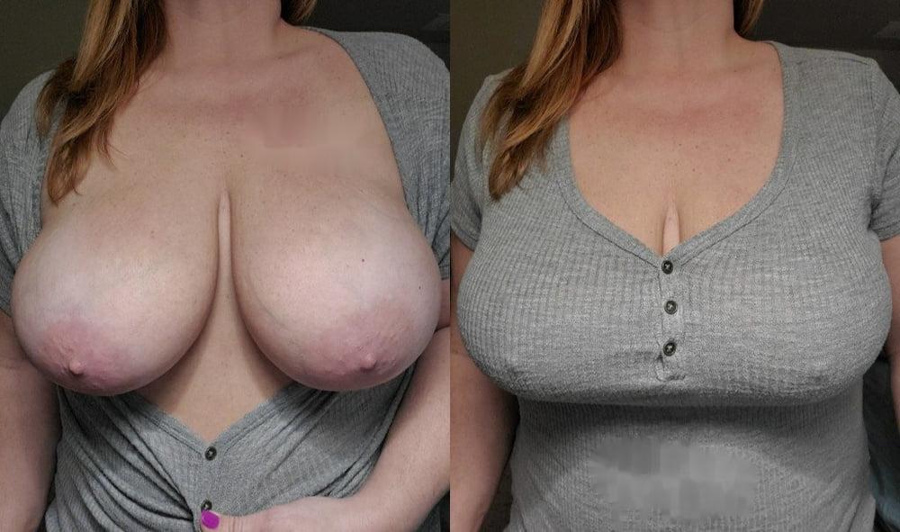 25P Breast Lovers Dream 1043
