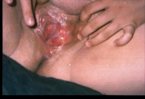 25P Canadian sexy wife