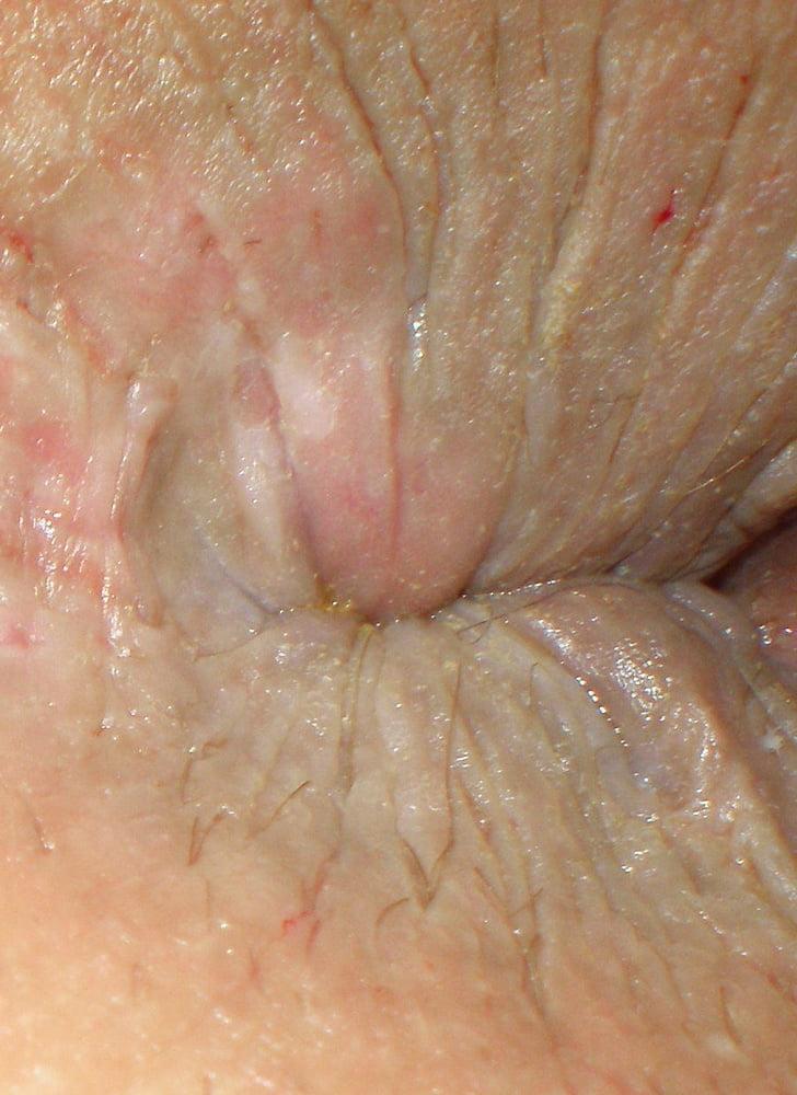 25P My girlie butthole as 19 year old