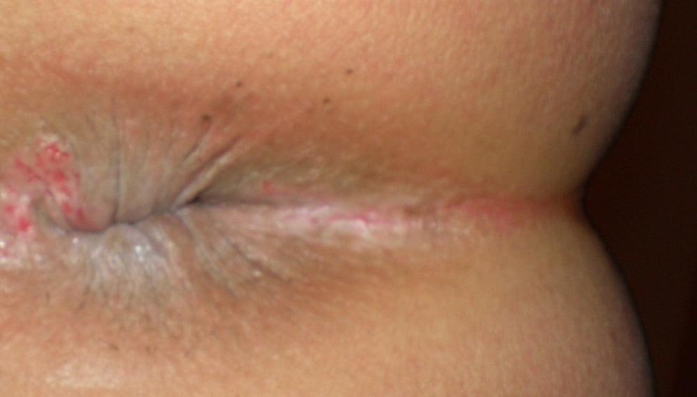 25P My girlie butthole as 19 year old