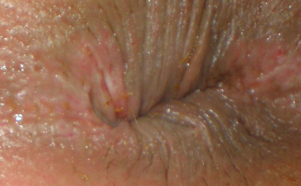 25P My girlie butthole as 19 year old
