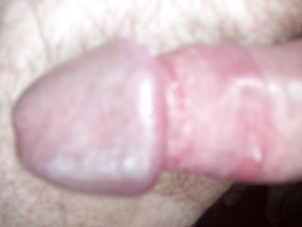 25P Mi pene