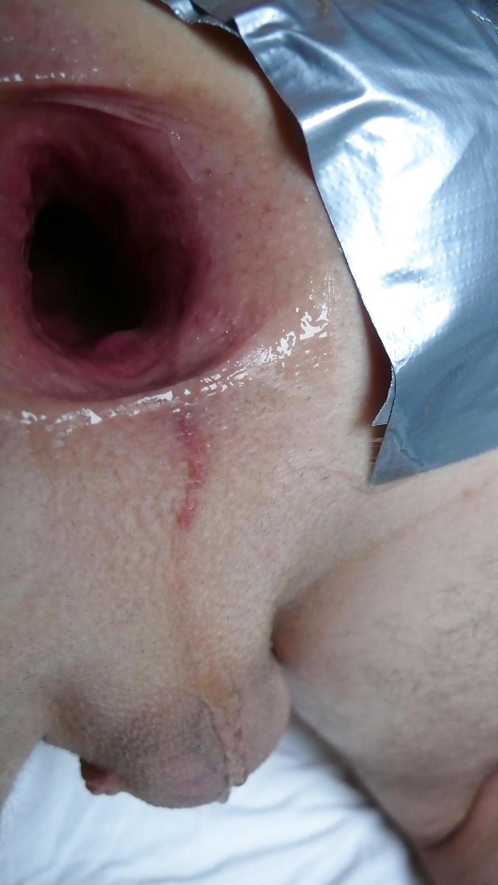 22P After al long break it's time to open my asshole big Gape
