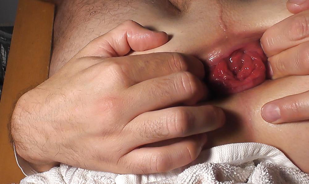 25P My gaping asshole 6,8cm okt. 2011 gape ass cock