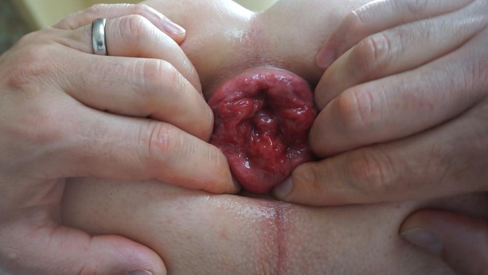 11P strech and prolapse asshole close up