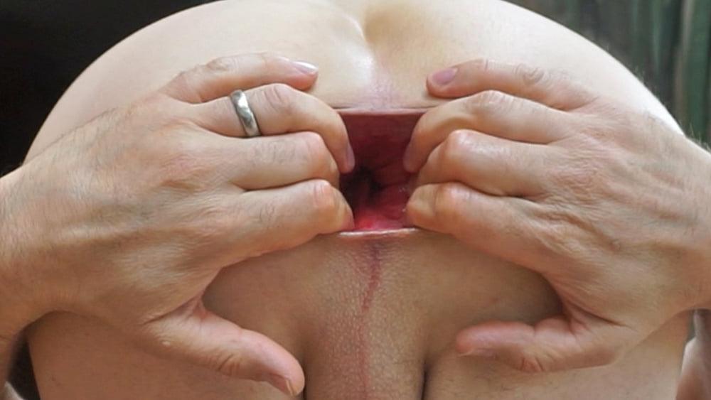 11P strech and prolapse asshole close up