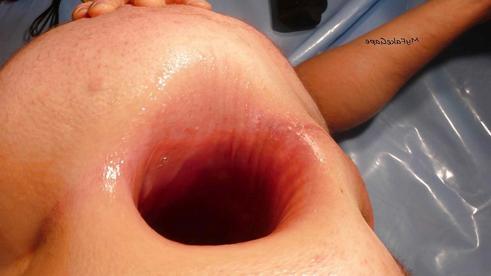 17P My FAKE gape 7 giant gaping asshole