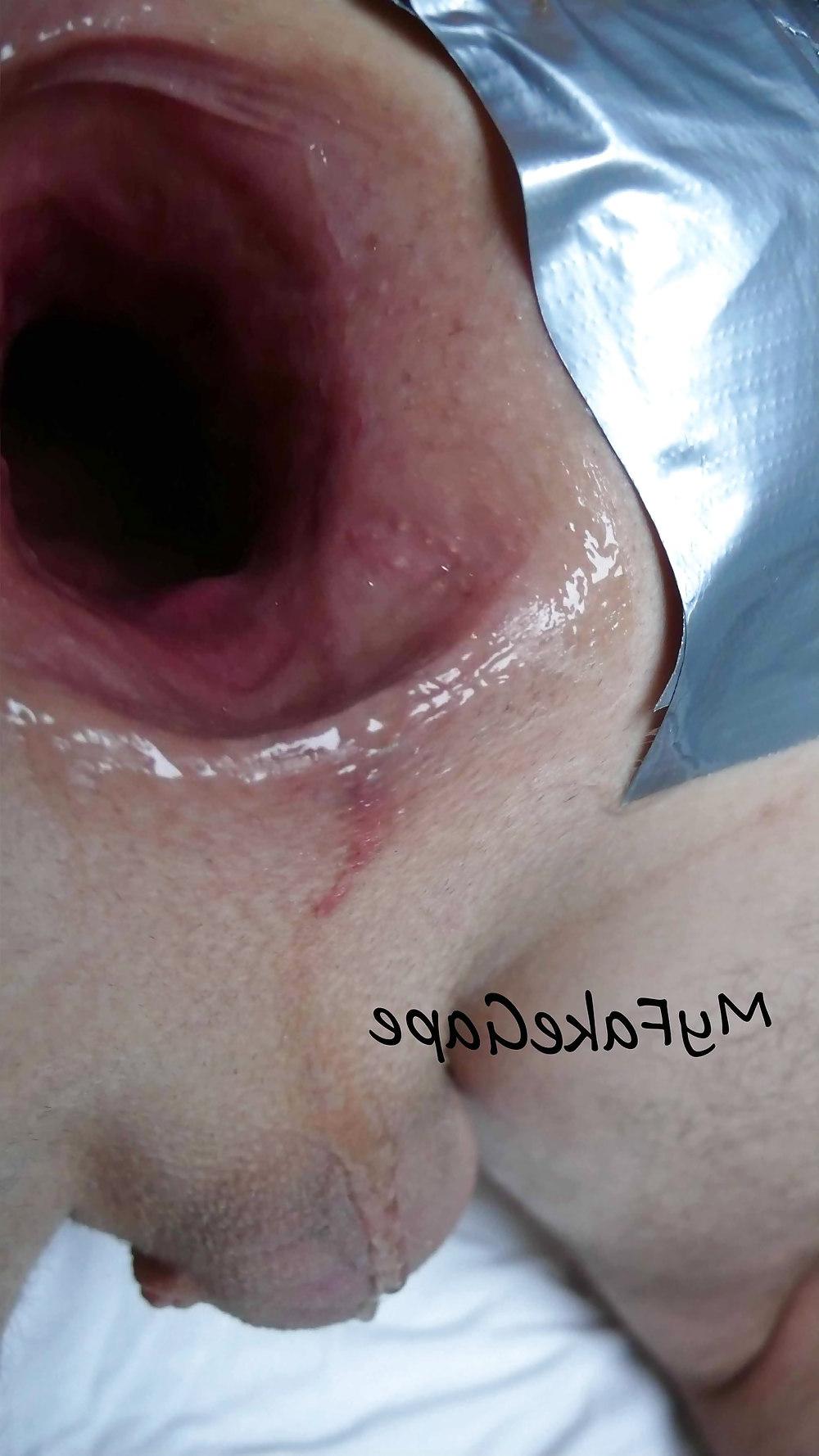 17P My FAKE gape 7 giant gaping asshole