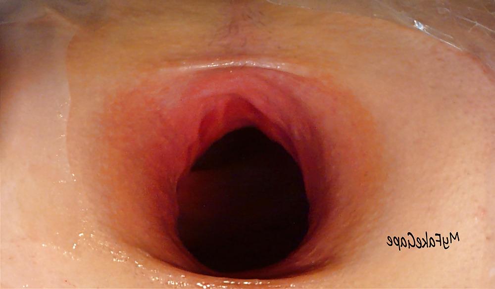 17P My FAKE gape 7 giant gaping asshole