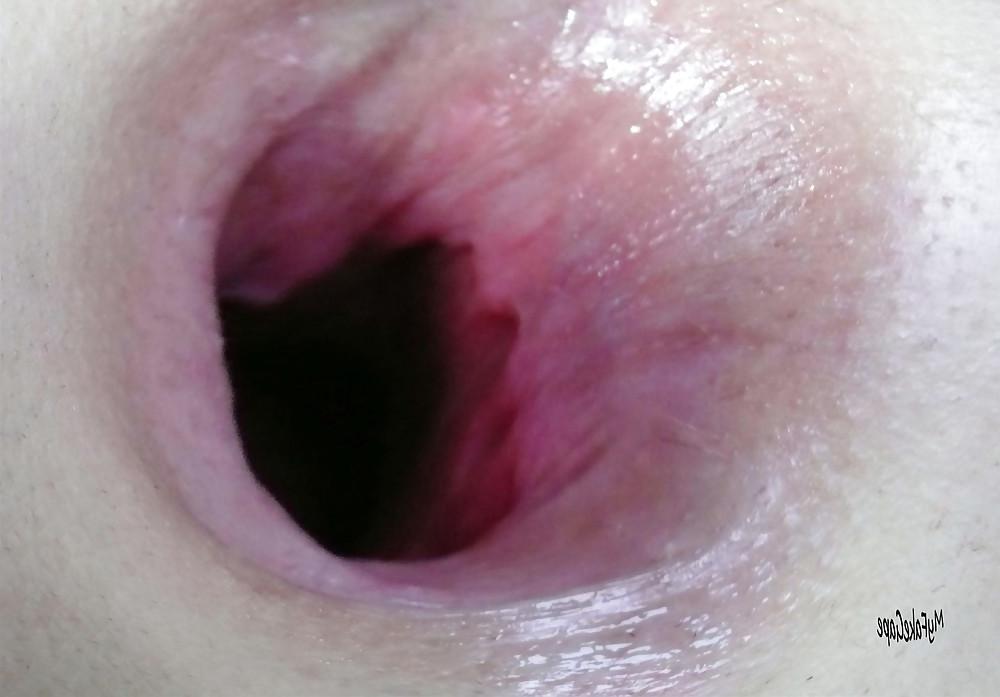 17P My FAKE gape 7 giant gaping asshole