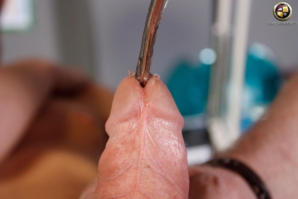 19P The doctor uses a urethral sound on Desmonds teenage cock