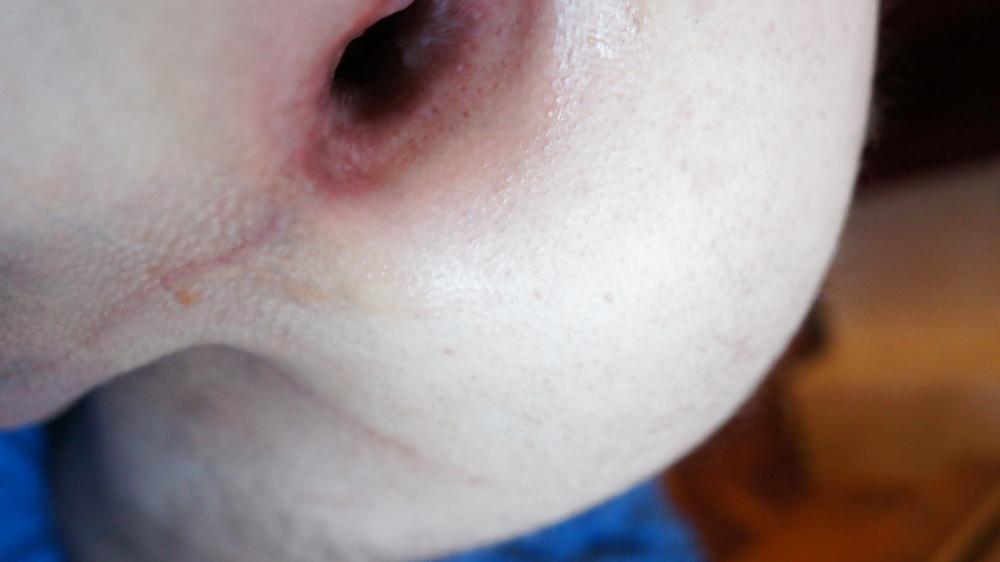 14P Gape and fist my giant asshole to my biggest gape june 2013