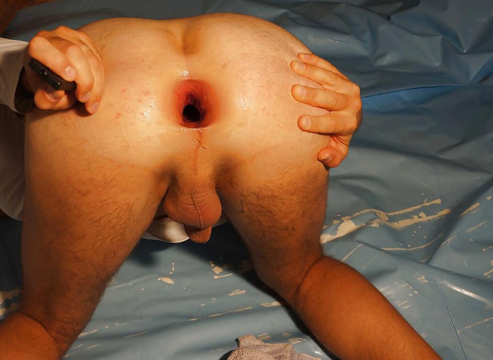 11P A big bottle spreading my asshole to a fantastic gape Part 1