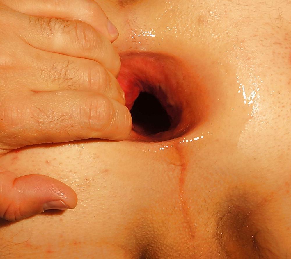 11P A big bottle spreading my asshole to a fantastic gape Part 1