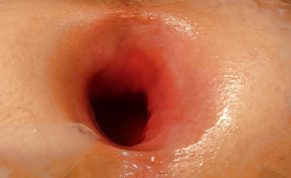 13P My gaping asshole 2009 older pics2008-2009