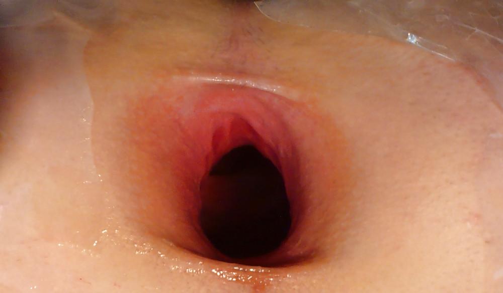 13P My gaping asshole 2009 older pics2008-2009