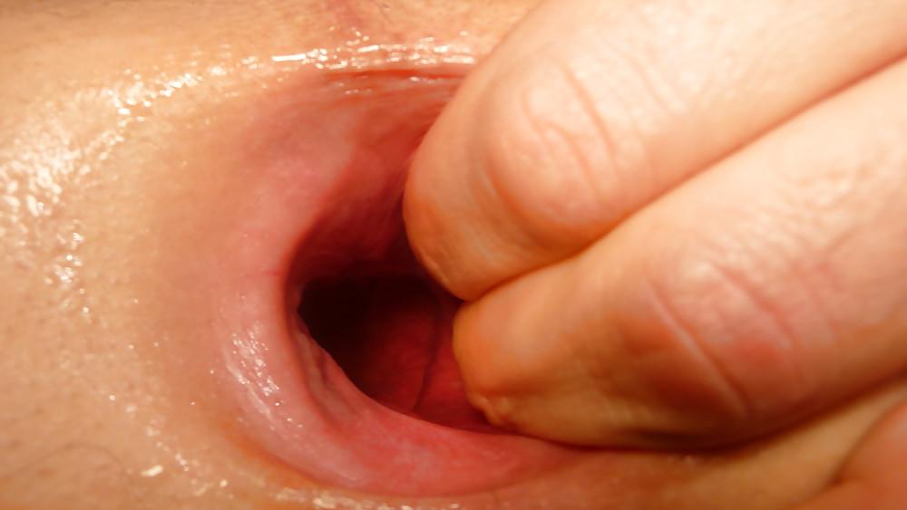 13P My gaping asshole 2009 older pics2008-2009