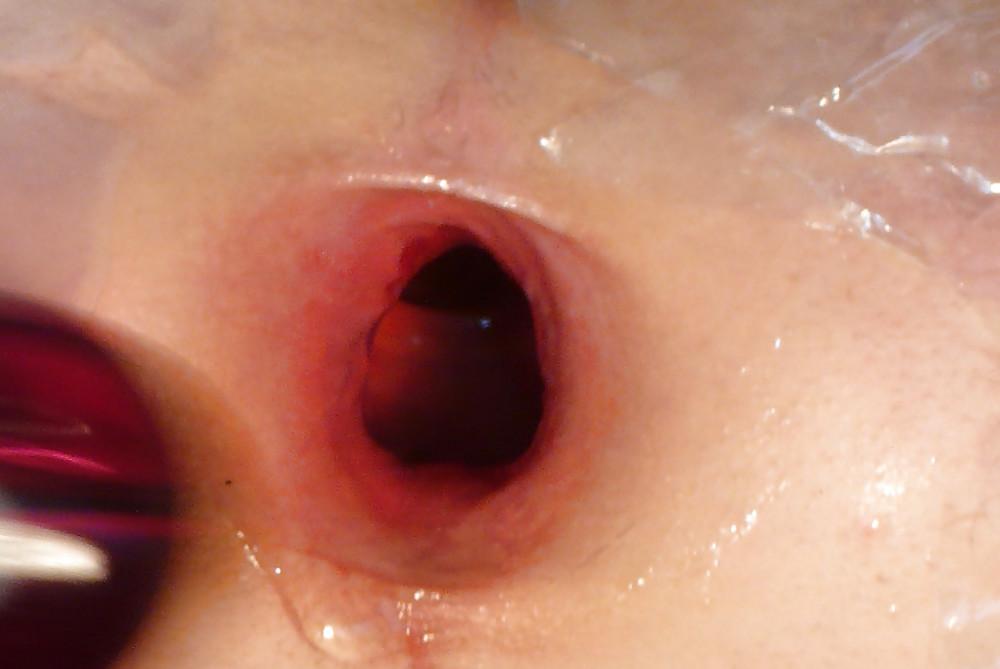 13P My gaping asshole 2009 older pics2008-2009