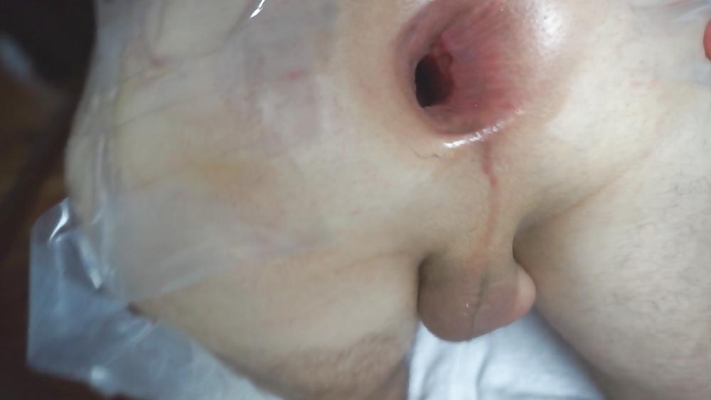 13P Anal gaping wide open asshole august 2015