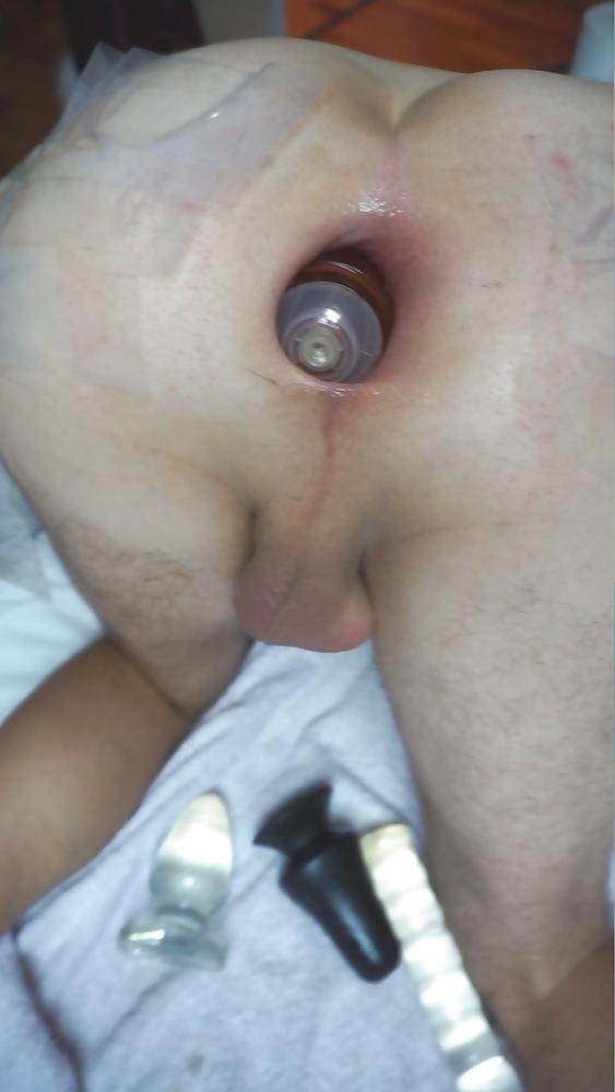 13P Anal gaping wide open asshole august 2015