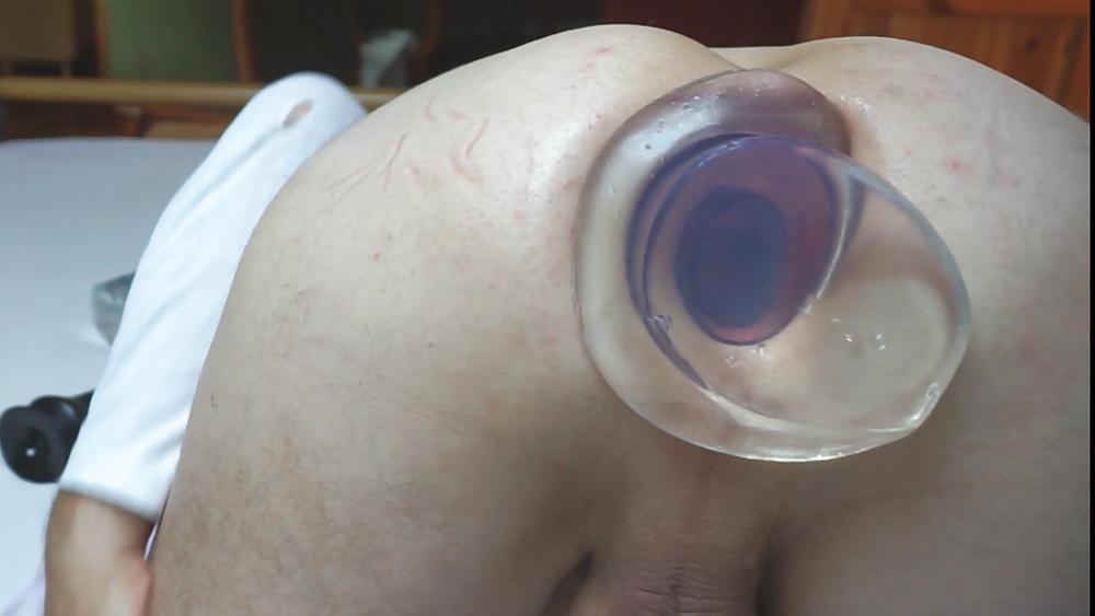 13P Anal gaping wide open asshole august 2015