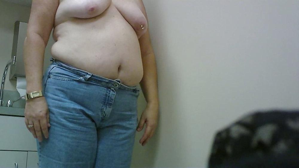 11P Wife breast aug consultation 02
