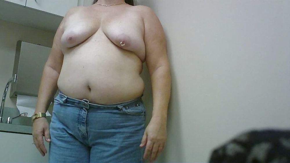 11P Wife breast aug consultation 02
