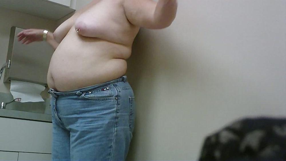 11P Wife breast aug consultation 02
