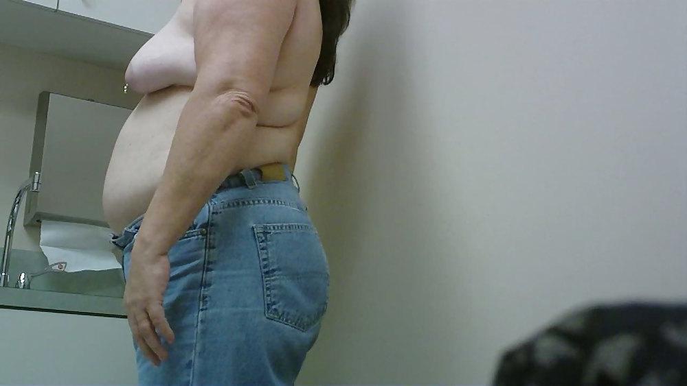 11P Wife breast aug consultation 02