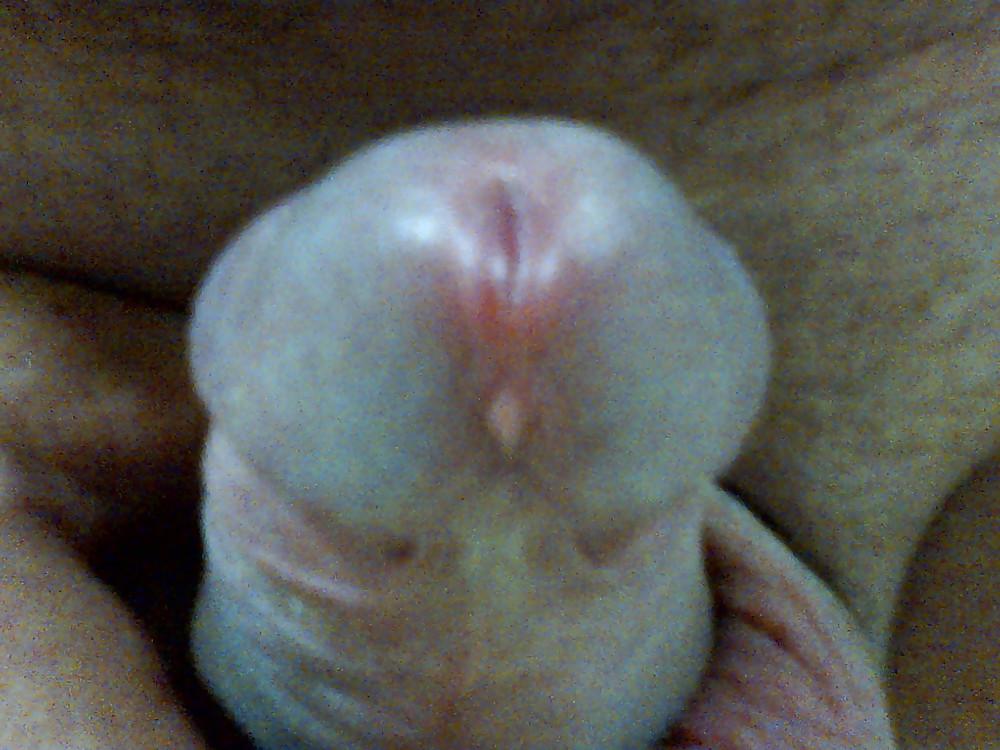 15P My penis