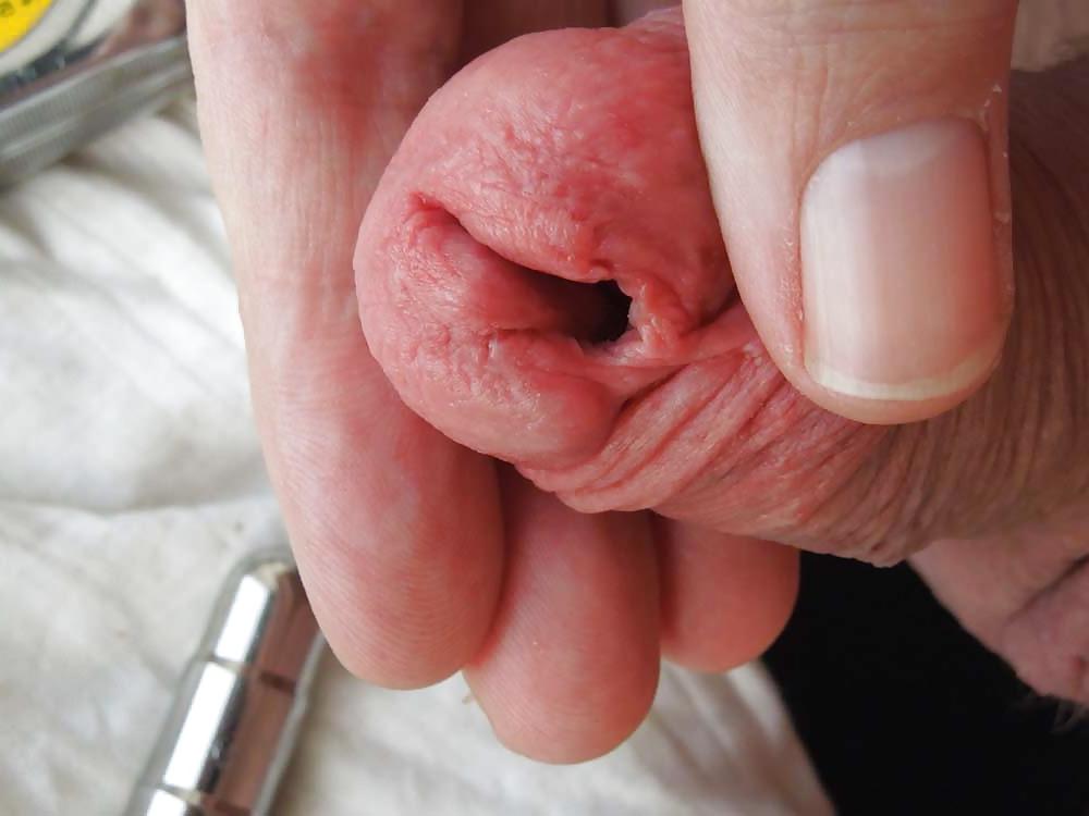 16P New penis plug urethra strectcher
