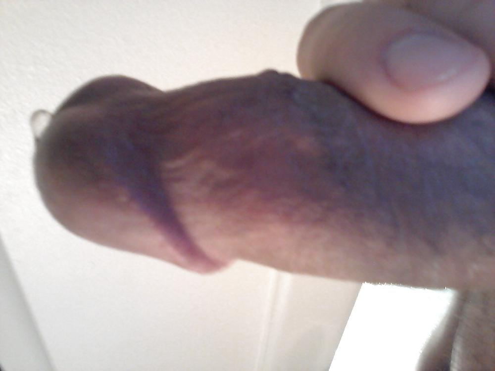 8P Penis Freedom