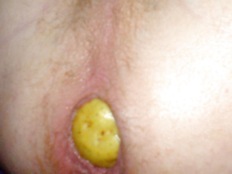 25P Toys for my Asshole-play with me