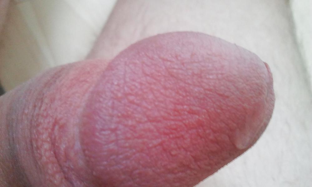 7P My Penis pics part 2