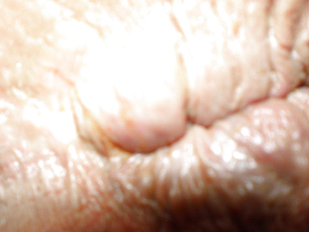 18P Playing with my butthole