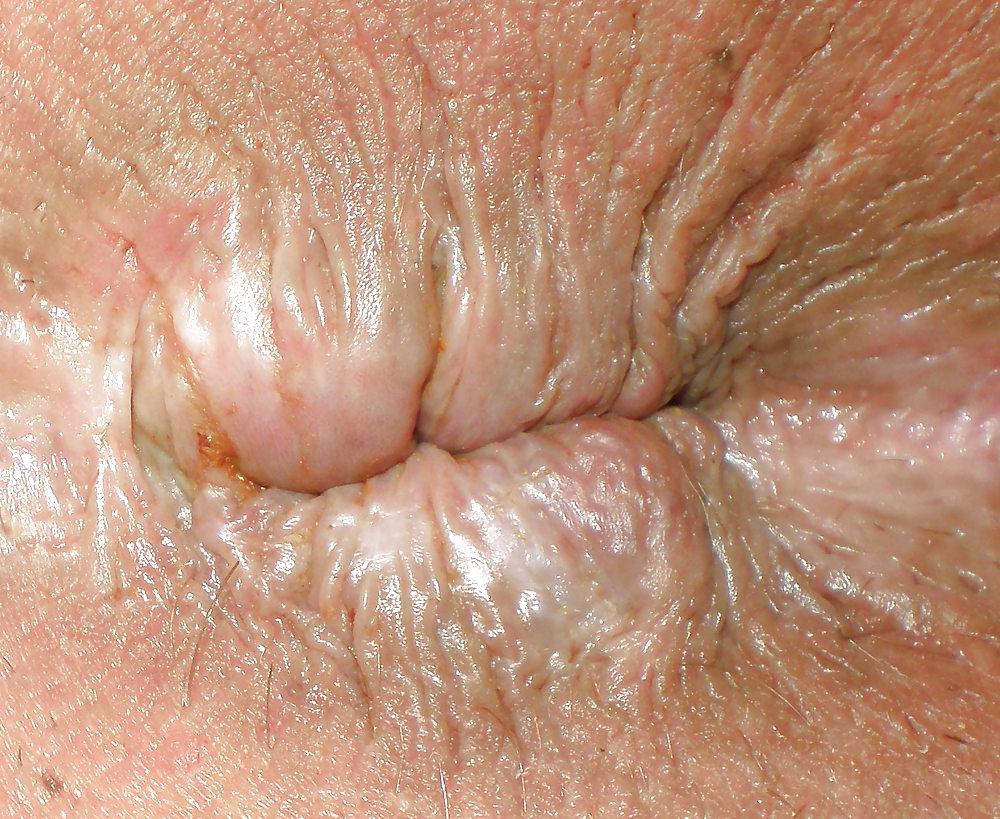 18P Playing with my butthole