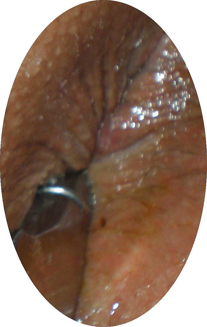 18P Playing with my butthole