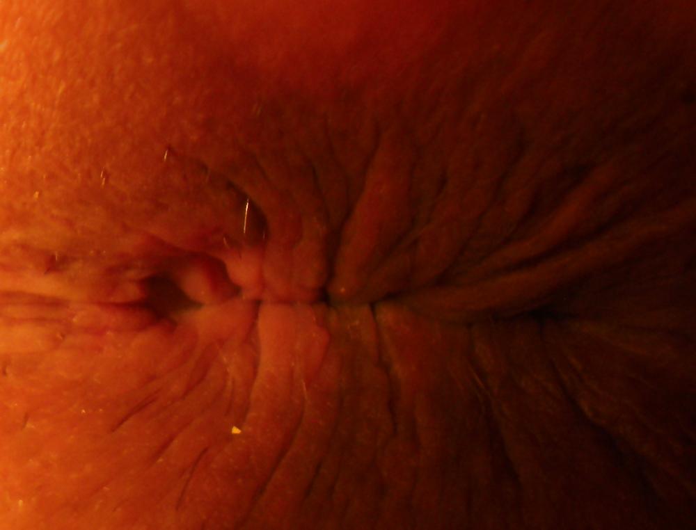 18P Playing with my butthole