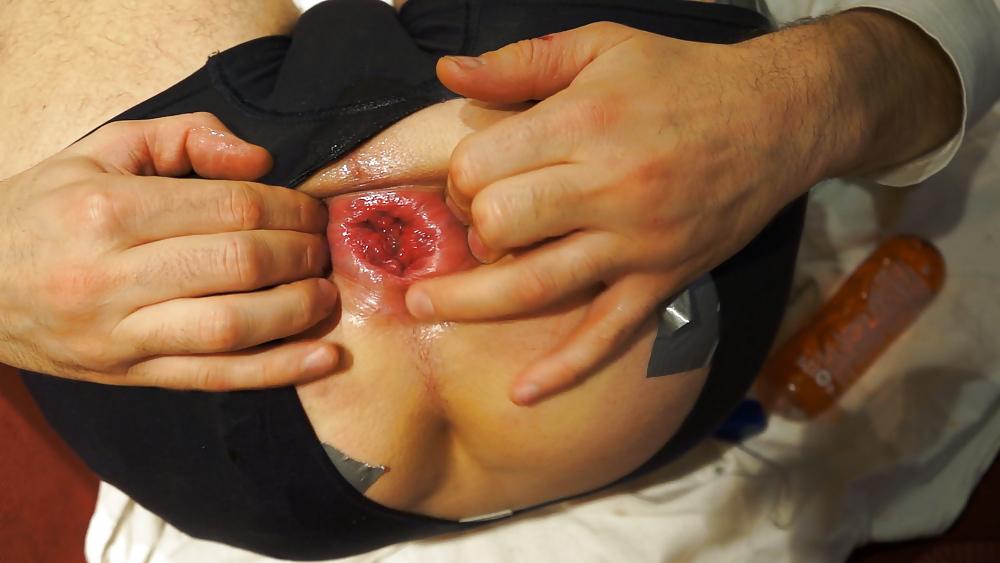 18P My asshole spread fist prolapse and gape Dez 2012