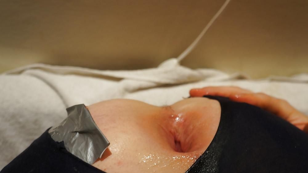 18P My asshole spread fist prolapse and gape Dez 2012