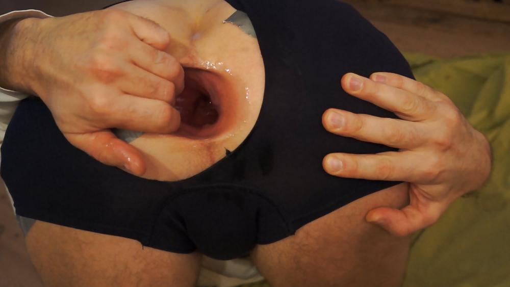 18P My asshole spread fist prolapse and gape Dez 2012