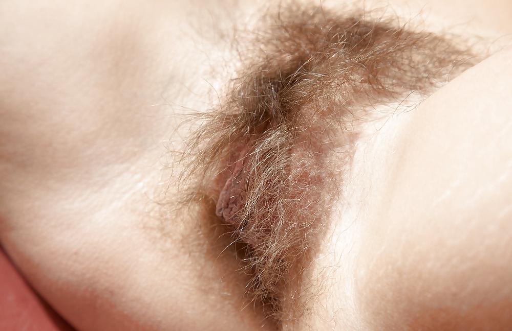 25P From the Moshe Files: Sweet Hirsute