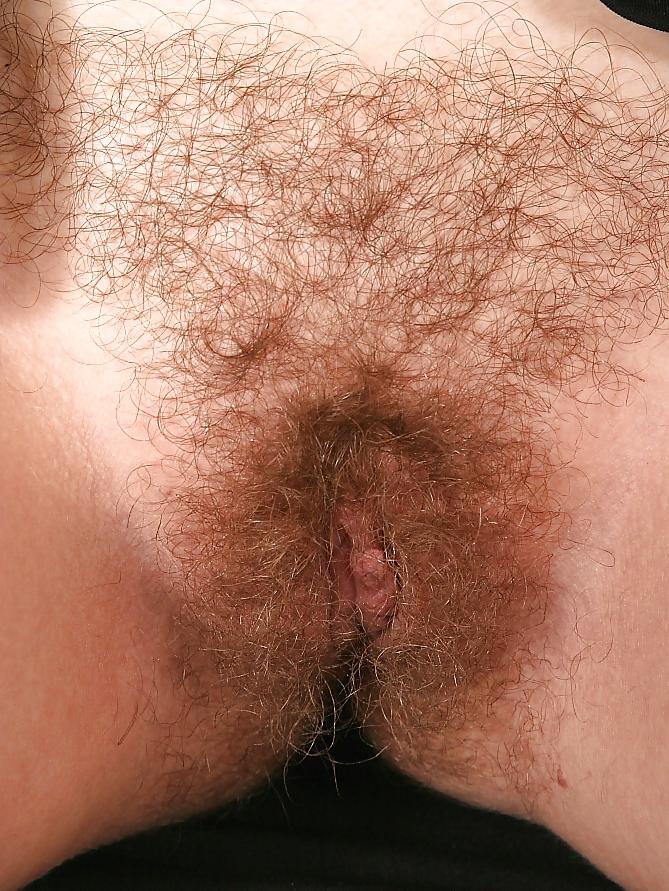 25P From the Moshe Files: Sweet Hirsute