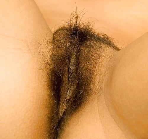 25P From the Moshe Files: Sweet Hirsute